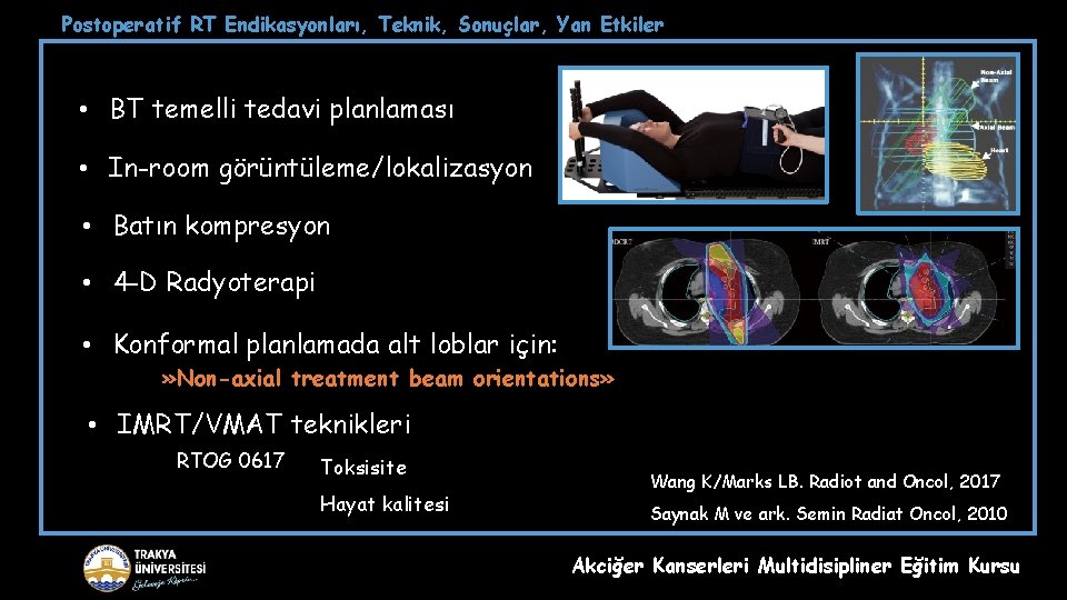 Postoperatif RT Endikasyonları, Teknik, Sonuçlar, Yan Etkiler • BT temelli tedavi planlaması • In-room