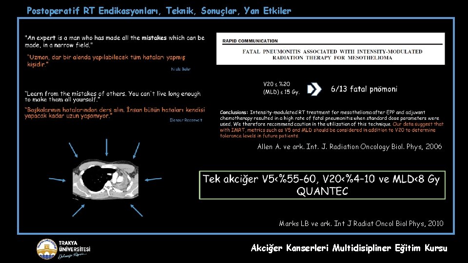 Postoperatif RT Endikasyonları, Teknik, Sonuçlar, Yan Etkiler Allen A. ve ark. Int. J. Radiation