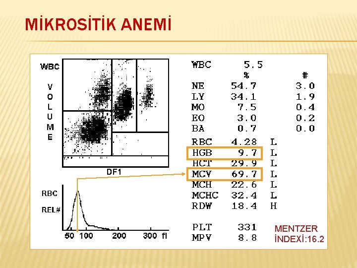 MİKROSİTİK ANEMİ MENTZER İNDEXİ: 16. 2 