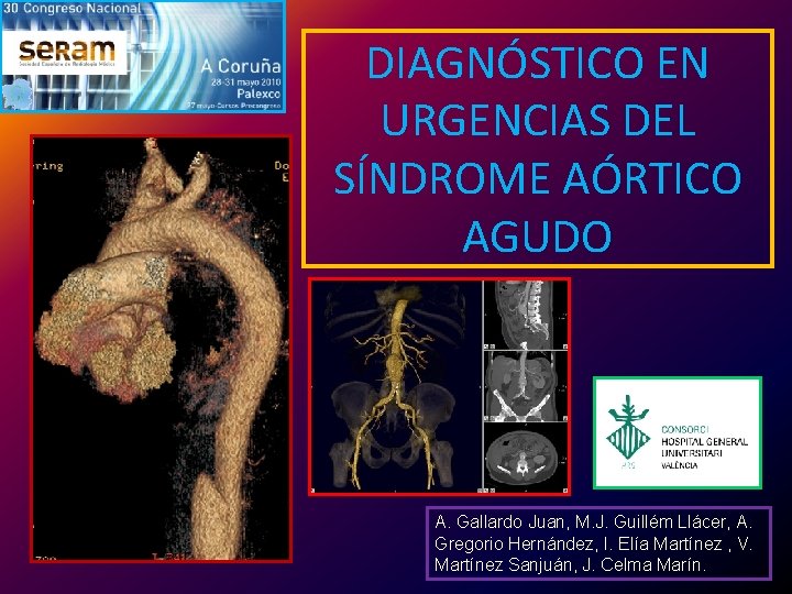 DIAGNÓSTICO EN URGENCIAS DEL SÍNDROME AÓRTICO AGUDO A. Gallardo Juan, M. J. Guillém Llácer,