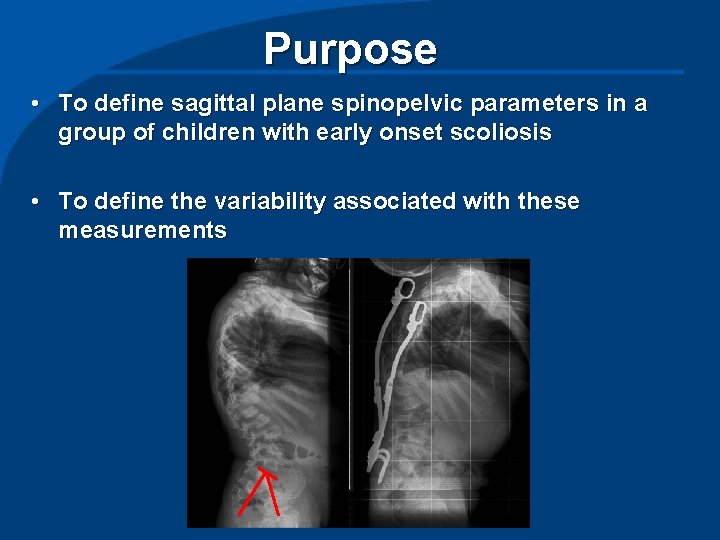 Purpose • To define sagittal plane spinopelvic parameters in a group of children with