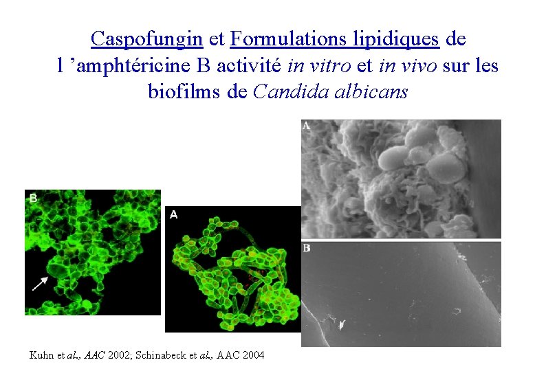 Caspofungin et Formulations lipidiques de l ’amphtéricine B activité in vitro et in vivo
