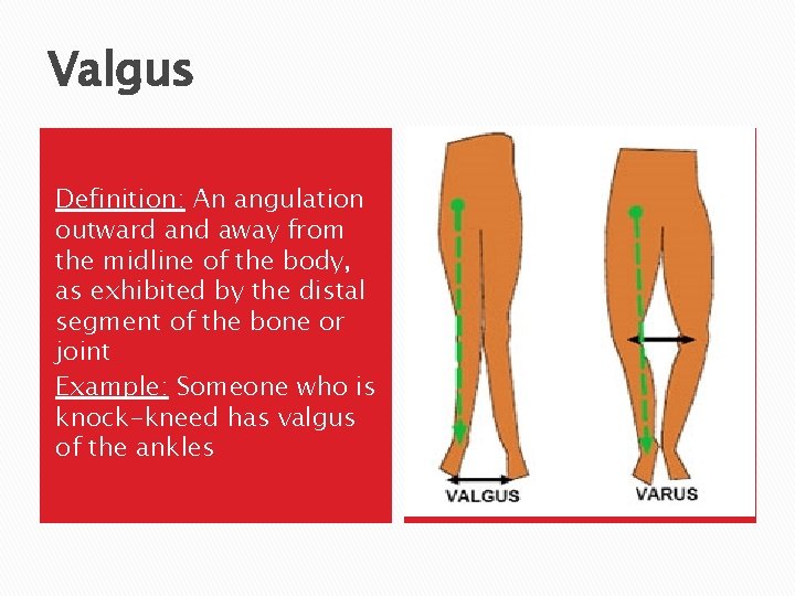 Valgus Definition: An angulation outward and away from the midline of the body, as
