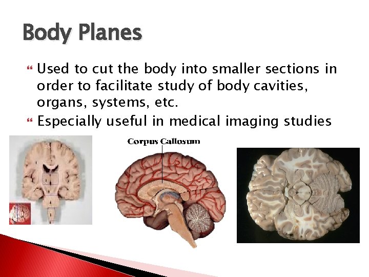 Body Planes Used to cut the body into smaller sections in order to facilitate