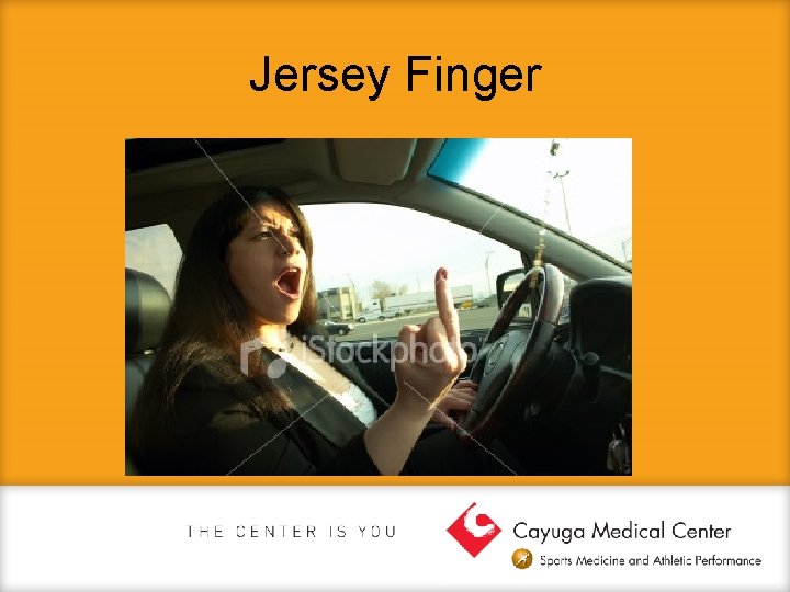 Jersey Finger 