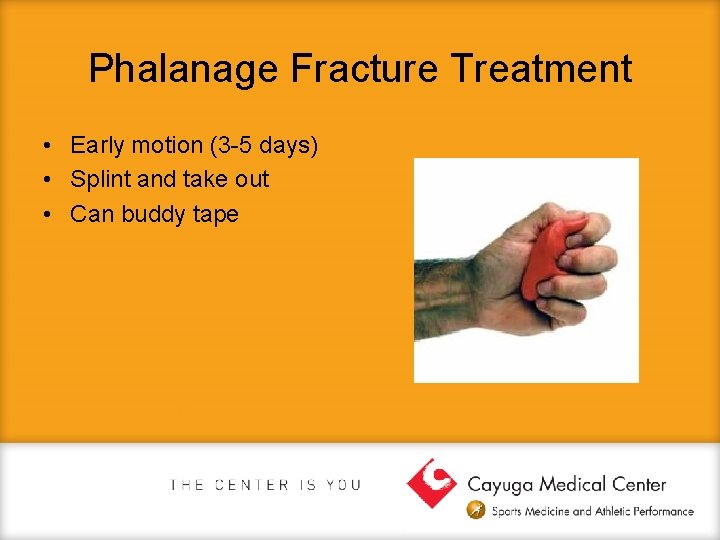 Phalanage Fracture Treatment • Early motion (3 -5 days) • Splint and take out