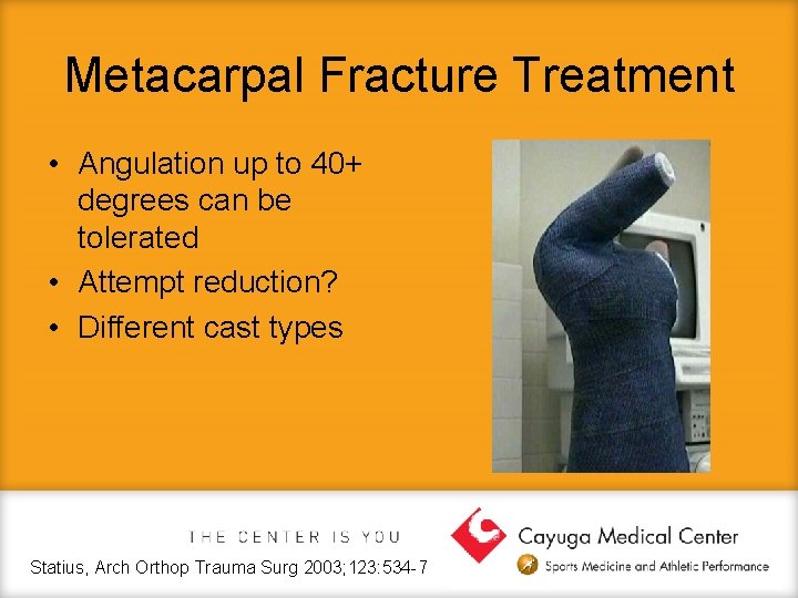 Metacarpal Fracture Treatment • Angulation up to 40+ degrees can be tolerated • Attempt