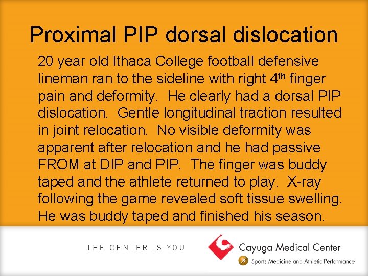 Proximal PIP dorsal dislocation 20 year old Ithaca College football defensive lineman ran to