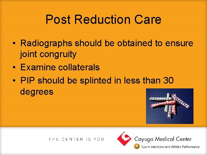 Post Reduction Care • Radiographs should be obtained to ensure joint congruity • Examine