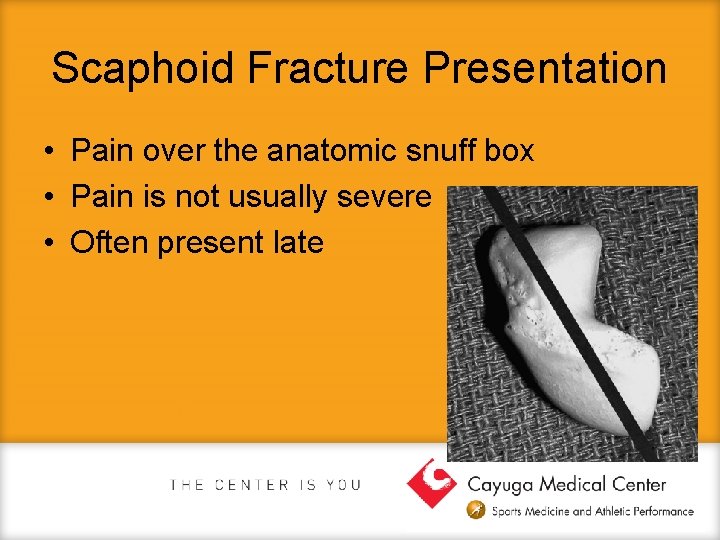 Scaphoid Fracture Presentation • Pain over the anatomic snuff box • Pain is not