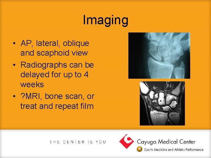 Imaging • AP, lateral, oblique and scaphoid view • Radiographs can be delayed for