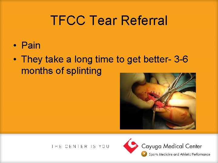 TFCC Tear Referral • Pain • They take a long time to get better-