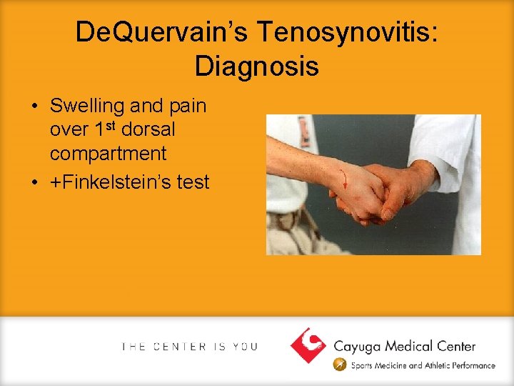 De. Quervain’s Tenosynovitis: Diagnosis • Swelling and pain over 1 st dorsal compartment •