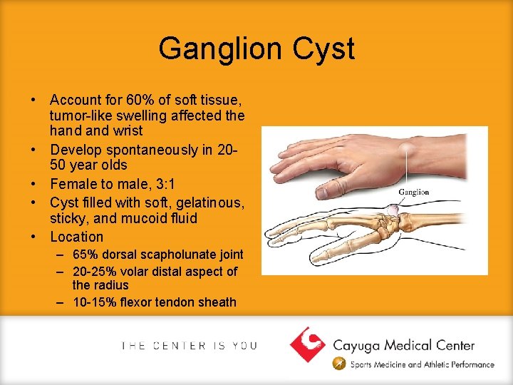 Ganglion Cyst • Account for 60% of soft tissue, tumor-like swelling affected the hand