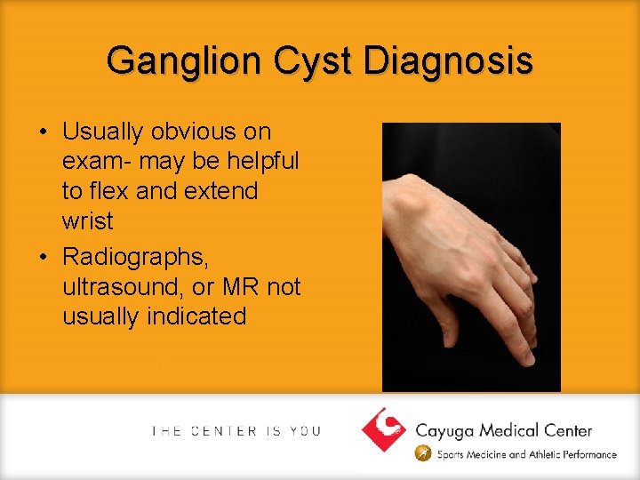 Ganglion Cyst Diagnosis • Usually obvious on exam- may be helpful to flex and