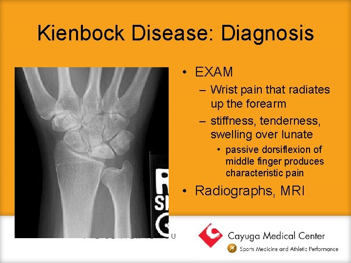 Kienbock Disease: Diagnosis • EXAM – Wrist pain that radiates up the forearm –