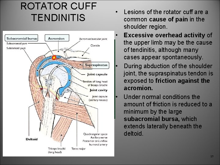 ROTATOR CUFF TENDINITIS • Lesions of the rotator cuff are a common cause of