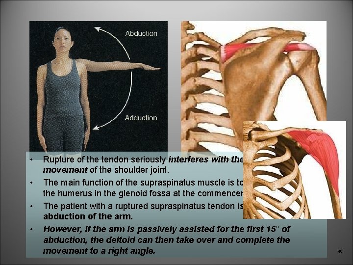  • • Rupture of the tendon seriously interferes with the normal abduction movement