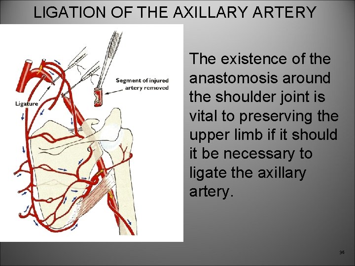 LIGATION OF THE AXILLARY ARTERY The existence of the anastomosis around the shoulder joint