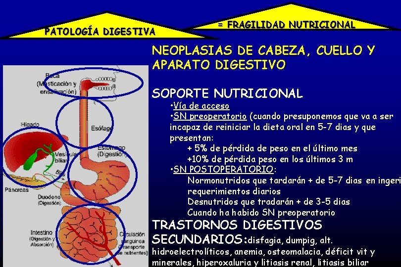 PATOLOGÍA DIGESTIVA = FRAGILIDAD NUTRICIONAL NEOPLASIAS DE CABEZA, CUELLO Y APARATO DIGESTIVO SOPORTE NUTRICIONAL