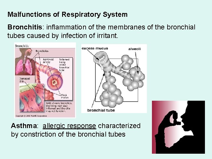 Malfunctions of Respiratory System Bronchitis: inflammation of the membranes of the bronchial tubes caused