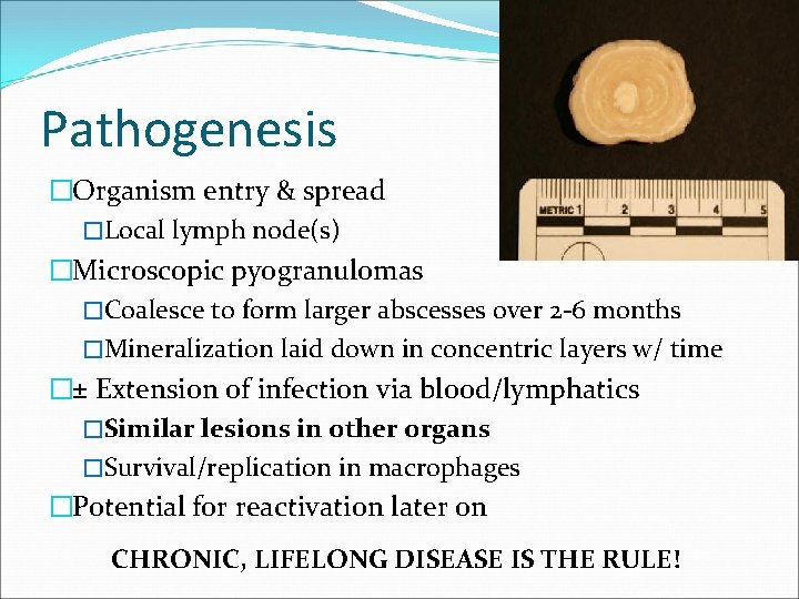 Pathogenesis �Organism entry & spread �Local lymph node(s) �Microscopic pyogranulomas �Coalesce to form larger