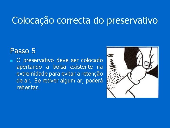 Colocação correcta do preservativo Passo 5 n O preservativo deve ser colocado apertando a