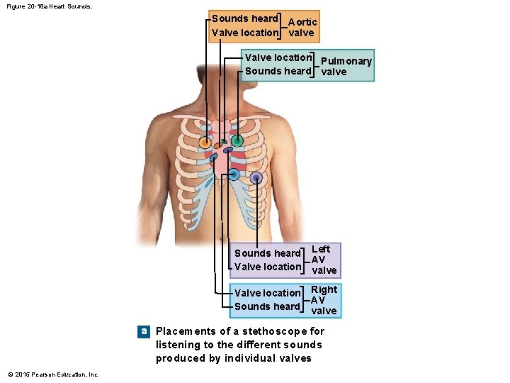 Figure 20 -18 a Heart Sounds heard Aortic Valve location valve Valve location Pulmonary