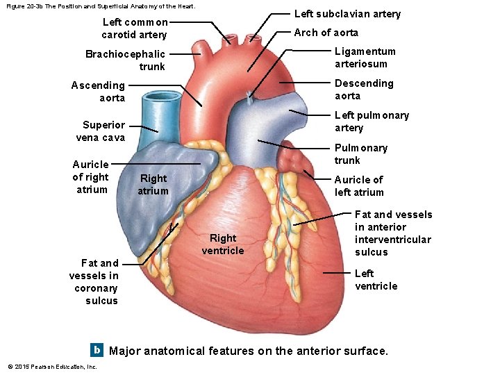 Figure 20 -3 b The Position and Superficial Anatomy of the Heart. Left subclavian