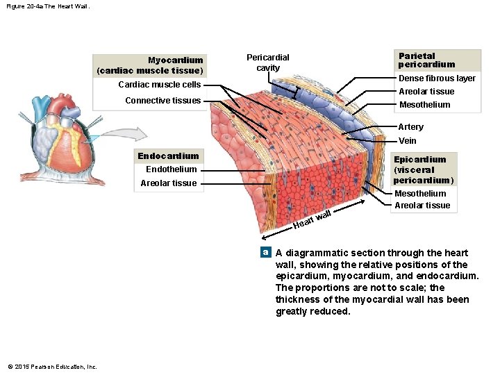 Figure 20 -4 a The Heart Wall. Myocardium (cardiac muscle tissue) Parietal pericardium Pericardial