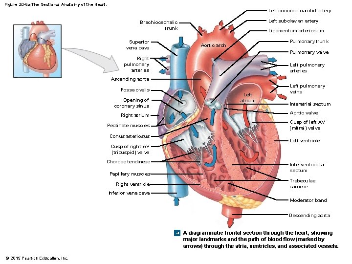 Figure 20 -6 a The Sectional Anatomy of the Heart. Left common carotid artery