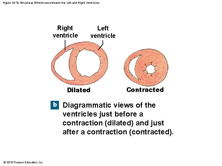 Figure 20 -7 b Structural Differences between the Left and Right Ventricles. Right ventricle