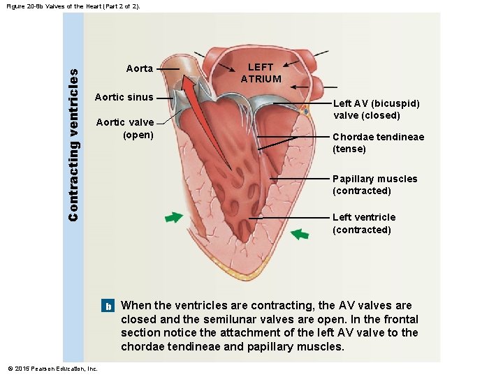 Contracting ventricles Figure 20 -8 b Valves of the Heart (Part 2 of 2).