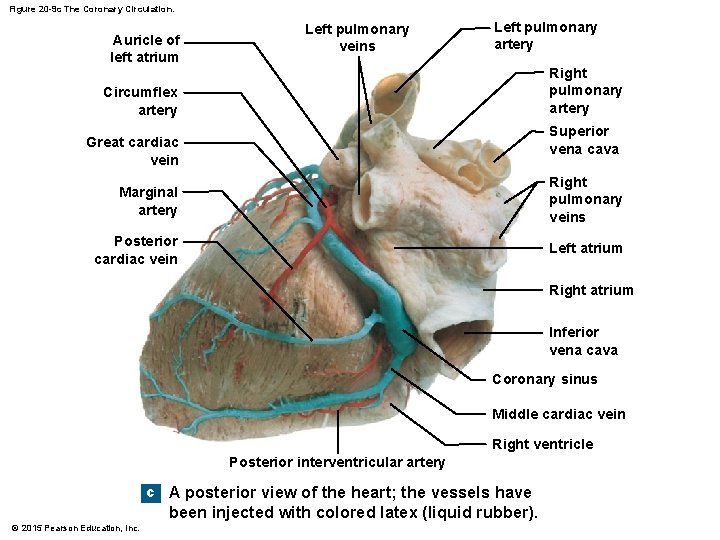 Figure 20 -9 c The Coronary Circulation. Auricle of left atrium Left pulmonary veins