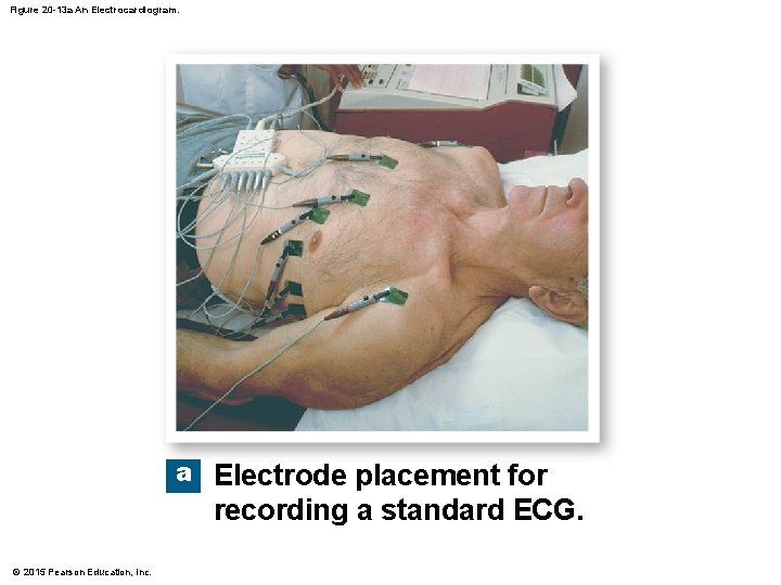 Figure 20 -13 a An Electrocardiogram. a Electrode placement for recording a standard ECG.