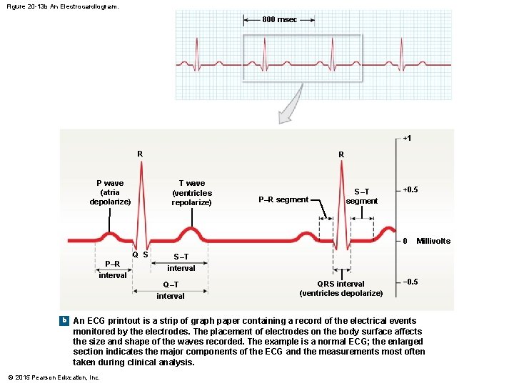 Figure 20 -13 b An Electrocardiogram. 800 msec +1 R P wave (atria depolarize)