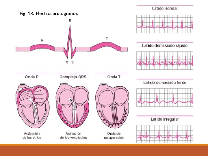 Fig. 18. Electrocardiograma. 