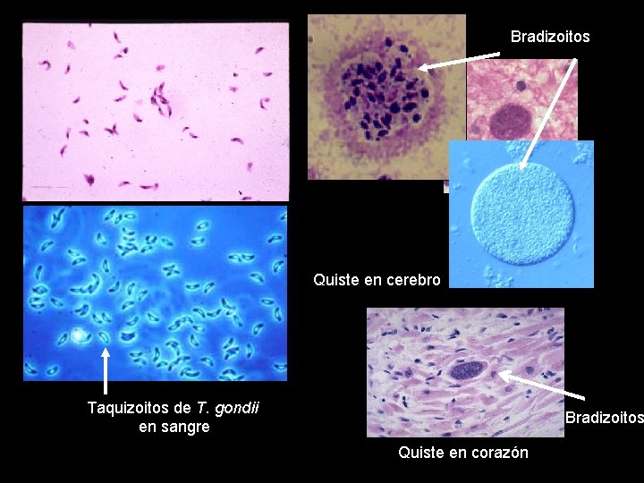 Bradizoitos Quiste en cerebro Taquizoitos de T. gondii en sangre Bradizoitos Quiste en corazón