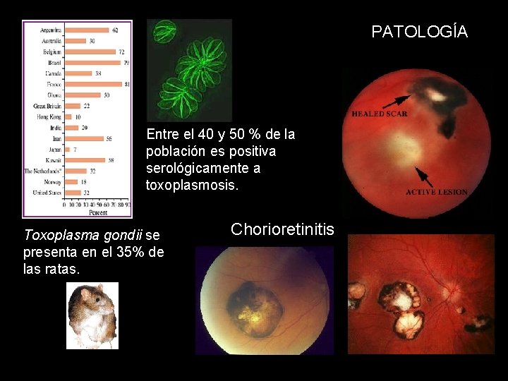 PATOLOGÍA Entre el 40 y 50 % de la población es positiva serológicamente a