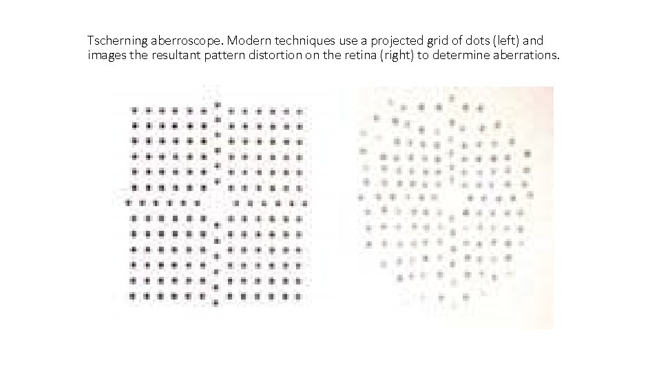Tscherning aberroscope. Modern techniques use a projected grid of dots (left) and images the