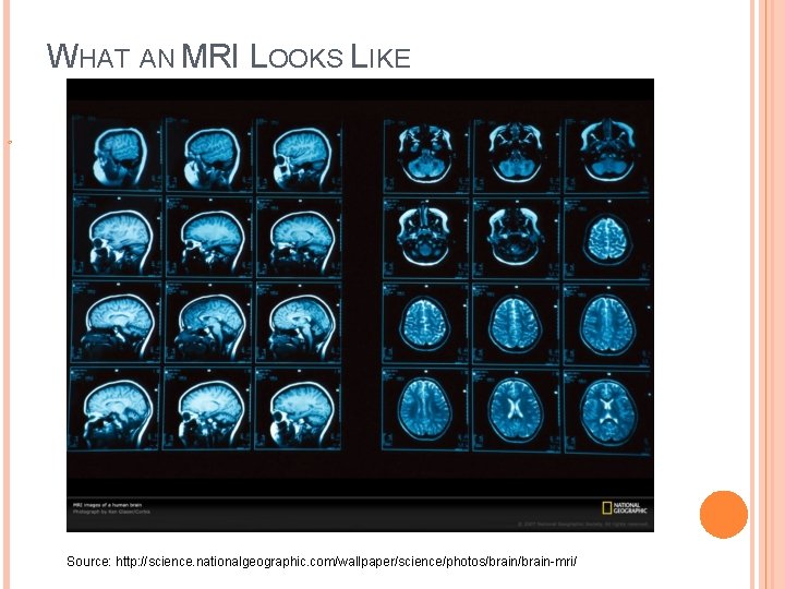 WHAT AN MRI LOOKS LIKE Source: http: //science. nationalgeographic. com/wallpaper/science/photos/brain-mri/ 