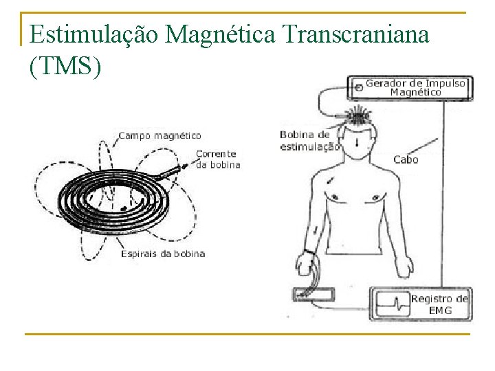 Estimulação Magnética Transcraniana (TMS) 