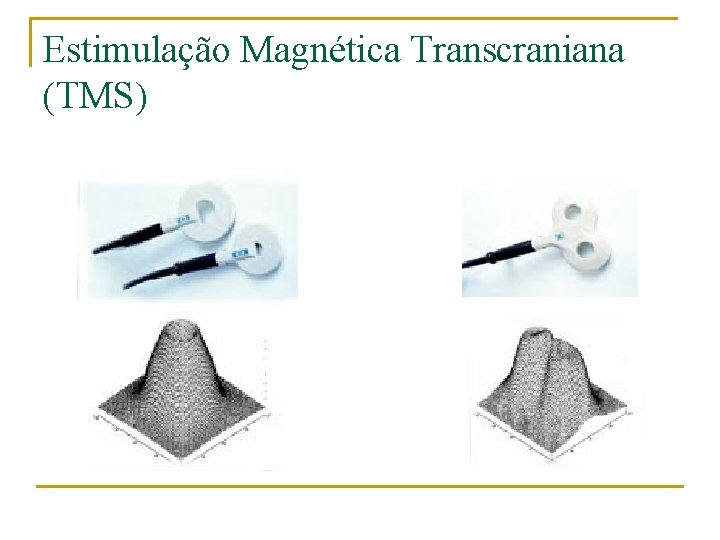 Estimulação Magnética Transcraniana (TMS) 