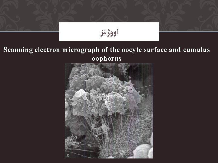  ﺍﻭﻭژﻨﺰ Scanning electron micrograph of the oocyte surface and cumulus oophorus 