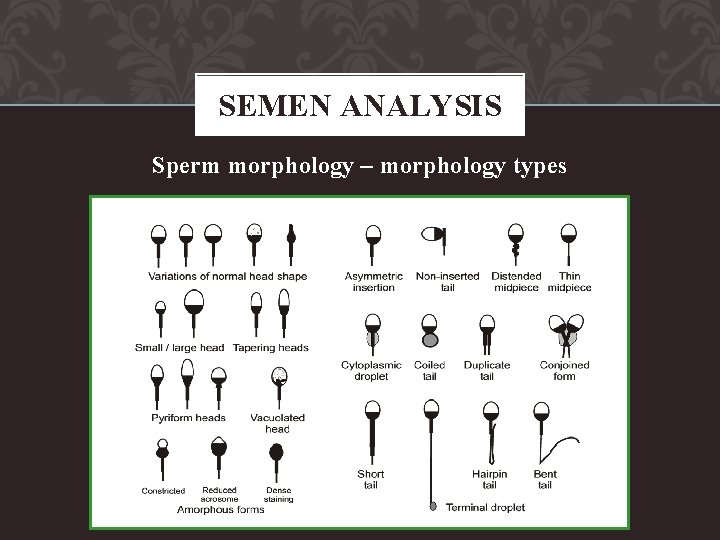 SEMEN ANALYSIS Sperm morphology – morphology types 