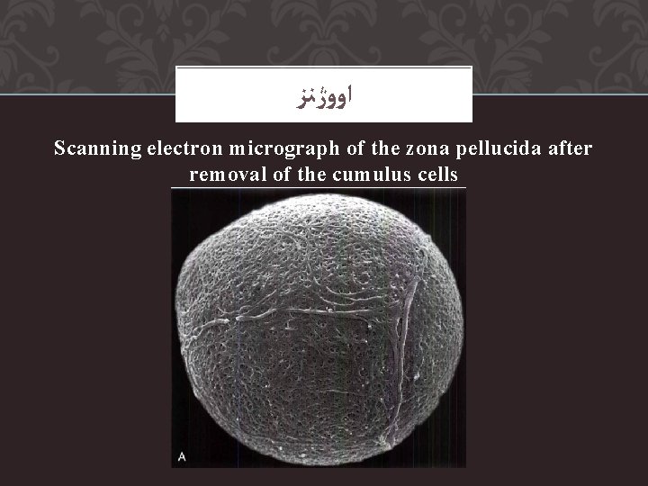  ﺍﻭﻭژﻨﺰ Scanning electron micrograph of the zona pellucida after removal of the cumulus