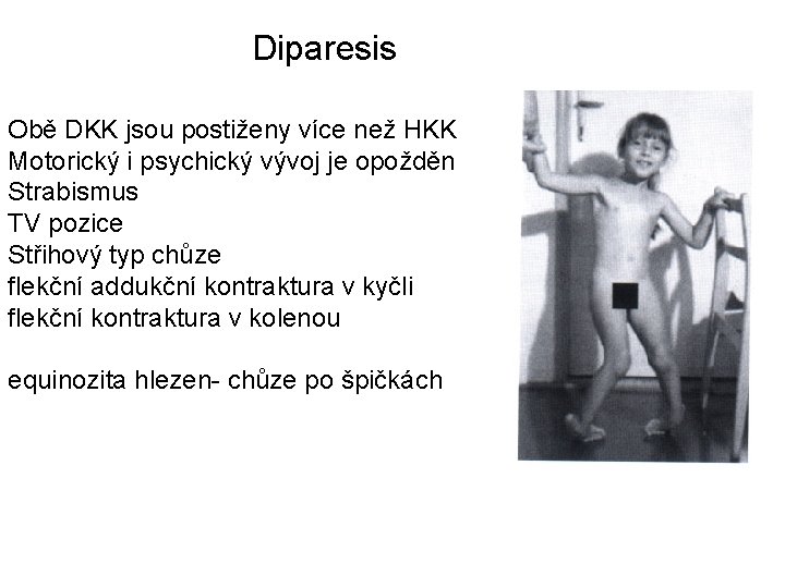 Diparesis Obě DKK jsou postiženy více než HKK Motorický i psychický vývoj je opožděn