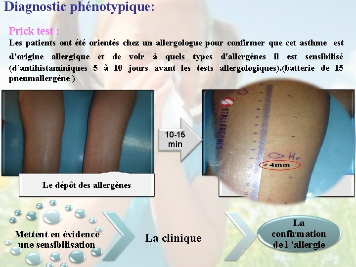 Diagnostic phénotypique: Prick test : Les patients ont été orientés chez un allergologue pour