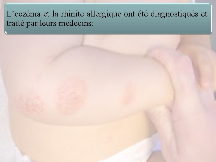 L’eczéma et la rhinite allergique ont été diagnostiqués et traité par leurs médecins: 