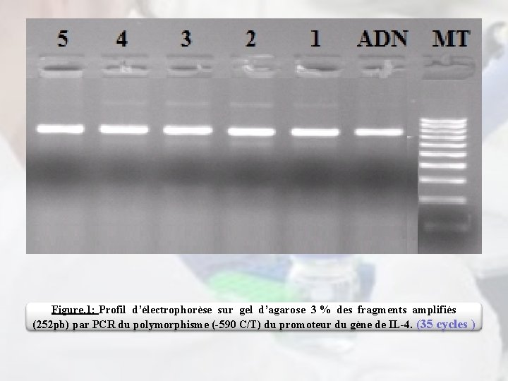 Figure. 1: Profil d’électrophorèse sur gel d’agarose 3 % des fragments amplifiés (252 pb)